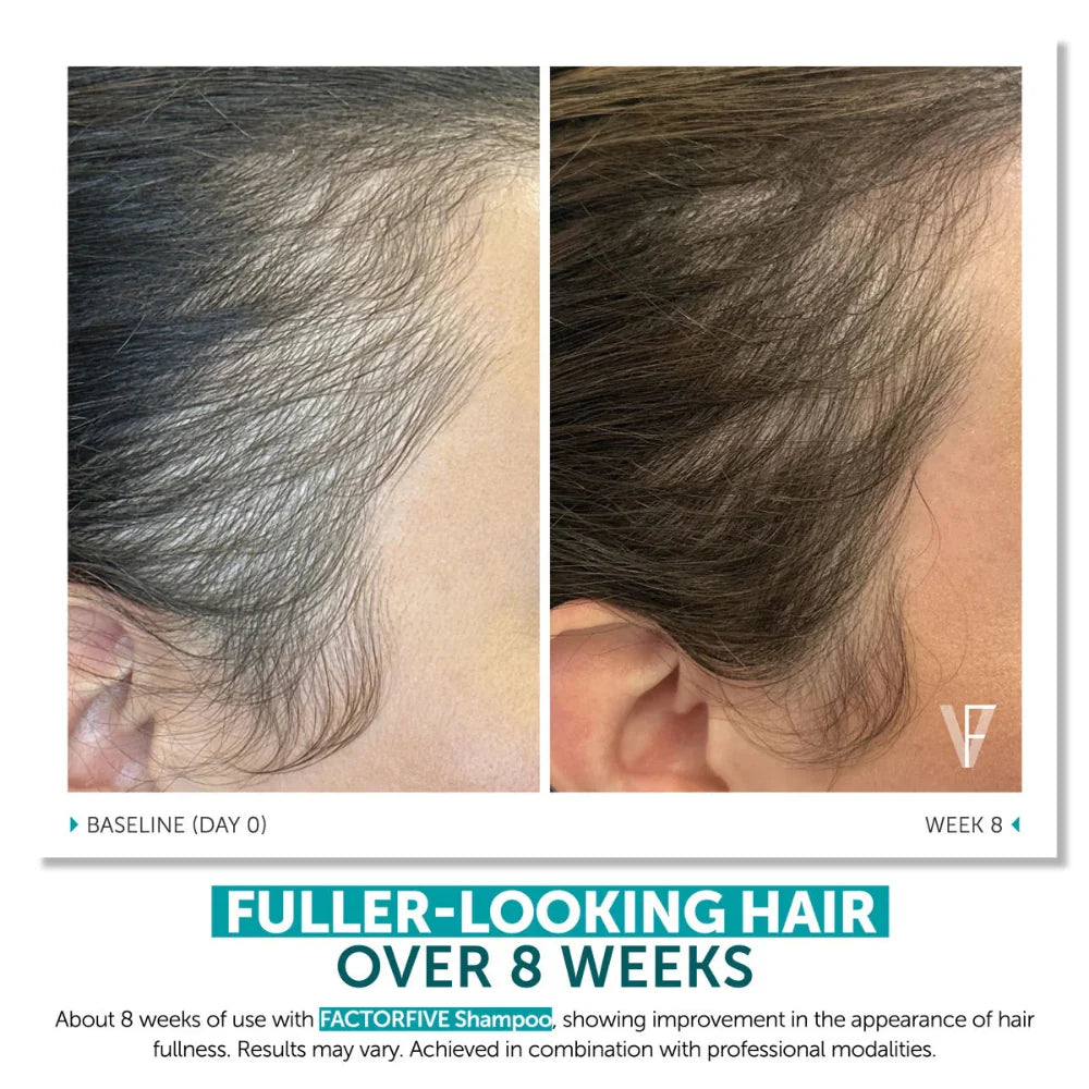 Shampoo Advanced Haircare System