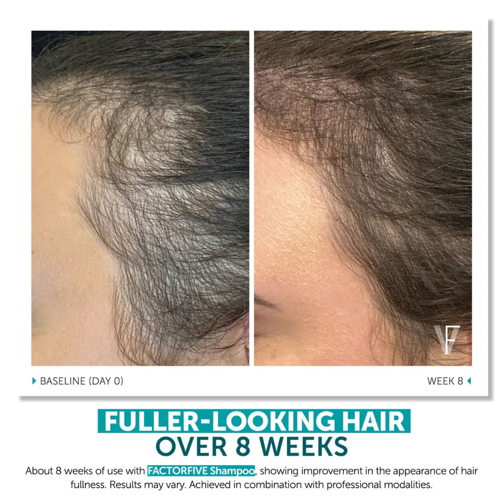 Shampoo Advanced Haircare System
